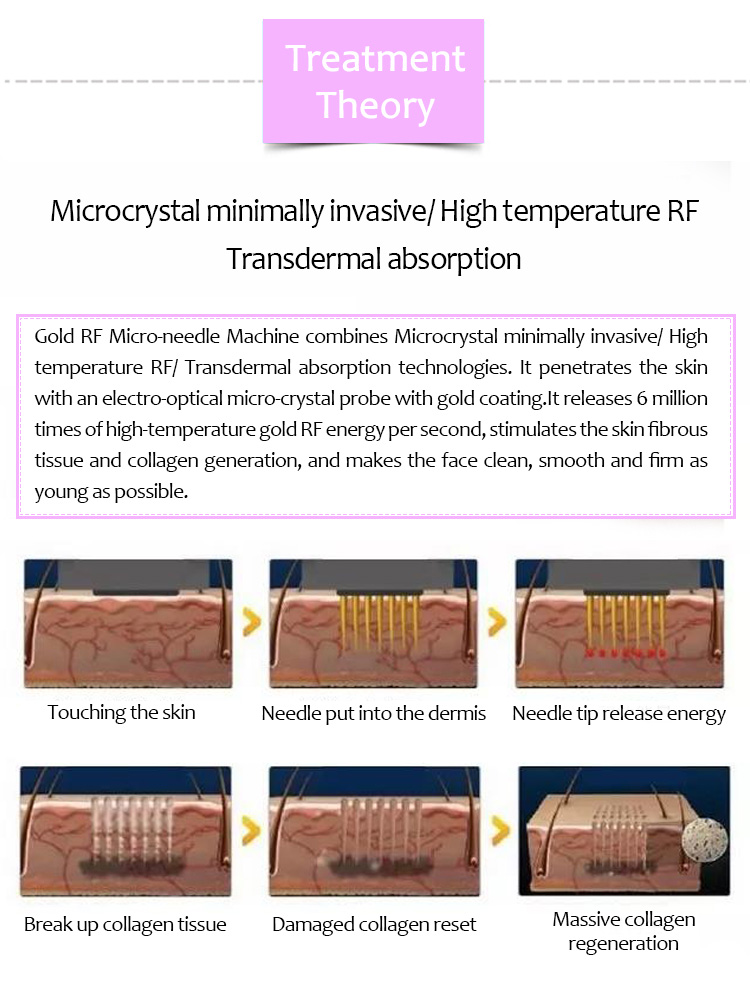 RF арьс өргөх, чангалах, сорви, батганы сорви арилгах машин, WZ02