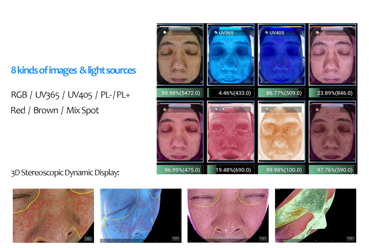 Analizador de piel facial 3D D8S con 8 tipos de imágenes y fuentes de luz