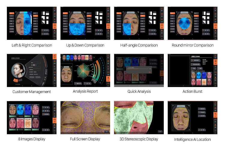 Analizador de piel facial 3D D8S con 8 tipos de imágenes y fuentes de luz