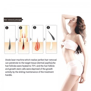 laser-hair-removal-how-it-works