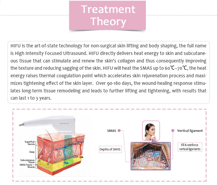 HIFU-Smart HIFU inteligente antiarrugas lifting facial estiramiento de la piel equipo de salón de belleza