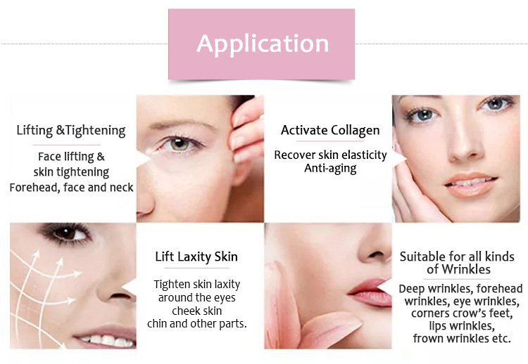 HIFU-Smart Smart HIFU Anti-Wrinkle Face Lifting Skin Tightening Beauty Salon Equipment