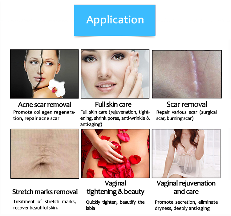 SM10600KKlb Vaginal Tightening Stretch Mark/Scar Removal Anti-Wrinkle Skin Resurfacing Machine