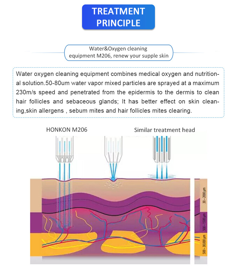 M206 Удаление прыщей Глубокая очистка Омоложение кожи Отбеливание кожи и увлажняющий аппарат для кожи