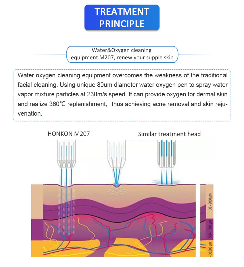 M207 Deeply Skin Cleaning Skin Rejuvenation And Skin Whitening Beauty Equipment