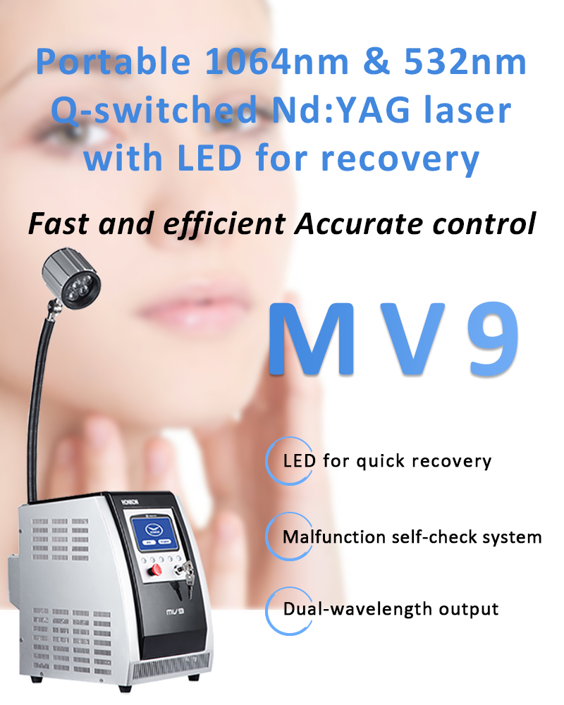 1064nm Q-Switched ND:YAG Lazer, Lazer Tatu Silme Maşın, Piqment Lezyonları Silmə Maşın, MV9