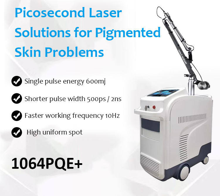 1064PQE+ 1064 nm ir 532 nm 500 AG pikosekundinis pigmento šalinimo lazeriu tatuiruočių šalinimo aparatas