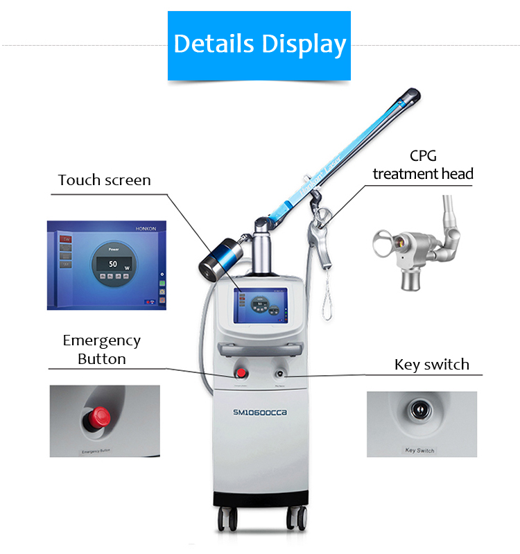 SM10600AL-30b Effektiv 10600nm CO2 Fraksiyalı Lazer Vaginal Daraldan Dərinin Yenilənməsi və Dartma İşarələrinin Təmizlənməsi