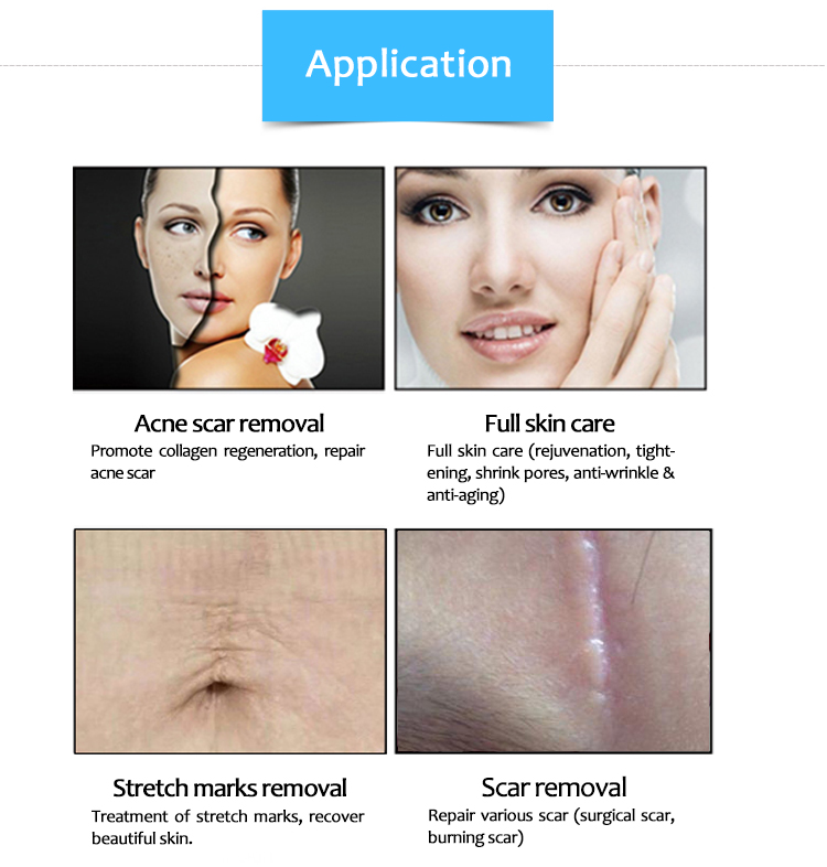 SM10600ZHa CO2 Fractional Laser Stretch Mark/Scar Removal & Skin Regeneration Machine