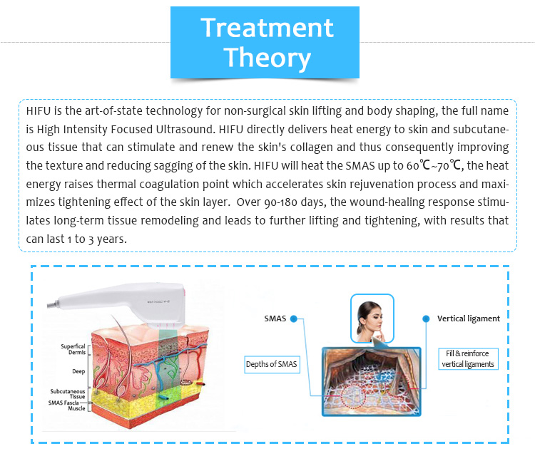 Ulove01 HIFU Удаление морщин Подтяжка кожи Антивозрастной лифтинг лица Оборудование для салонов красоты