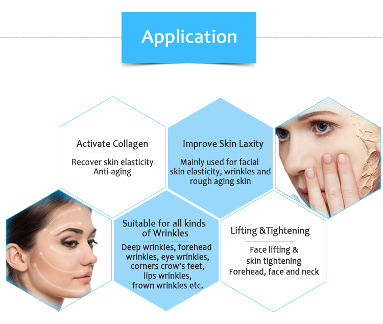 Ulove01 HIFU Wrinkle Removal Skin Tightening Anti-aging Face lifting Beauty Salon Equipment