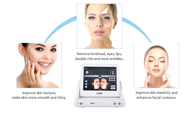 Ulove01 HIFU grumbu noņemšana, ādas pievilkšana, pretnovecošanās sejas liftings, skaistumkopšanas salona aprīkojums