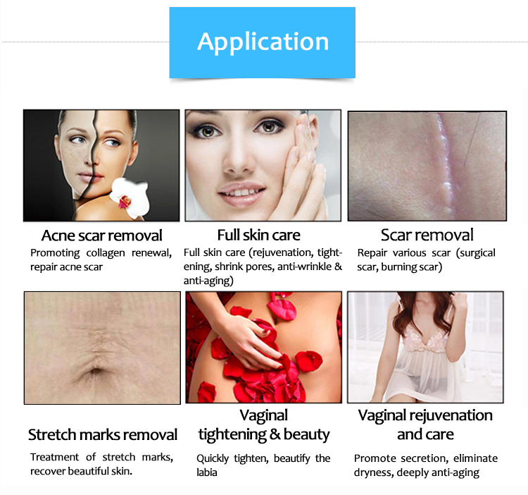 SM10600ZHb Vaginal Tightening Skin Resurfacing Anti-Aging Scar Removal Beauty Machine